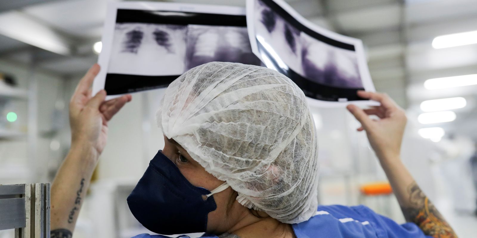 Diagnóstico tardio dá poucas chances de cura do câncer de